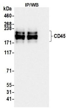 Rabbit anti-CD45 Recombinant Monoclonal Antibody [BL-178-12C7]