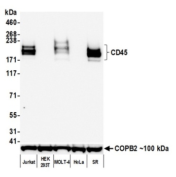 Rabbit anti-CD45 Recombinant Monoclonal Antibody [BL-178-12C7]