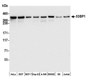Rabbit anti-53BP1 Recombinant Monoclonal Antibody [BL-250-1H11]