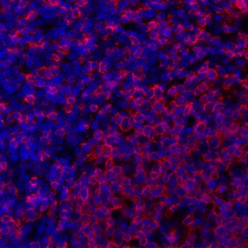 Mouse anti-HLA-DR Monoclonal Antibody, Purified [LN3]