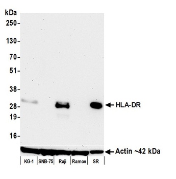 Mouse anti-HLA-DR Monoclonal Antibody, Purified [LN3]
