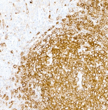 Mouse anti-HLA-DR Monoclonal Antibody, Purified [LN3]