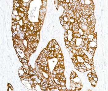 Mouse anti-Cytokeratin Monoclonal Antibody, Purified [AE1/AE3]