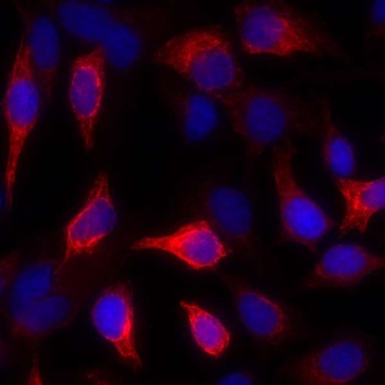 Mouse anti-Cytokeratin Monoclonal Antibody, Purified [AE1/AE3]