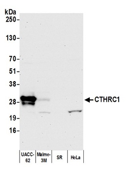 Rabbit anti-CTHRC1 Antibody, Affinity Purified