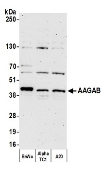 Rabbit anti-AAGAB Antibody, Affinity Purified