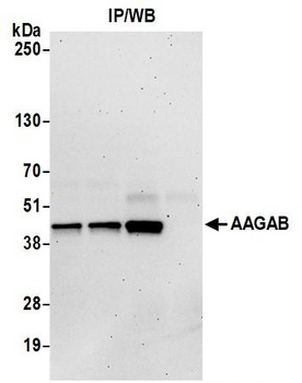 Rabbit anti-AAGAB Antibody, Affinity Purified