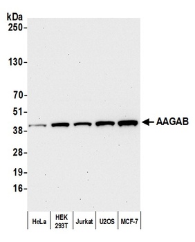 Rabbit anti-AAGAB Antibody, Affinity Purified