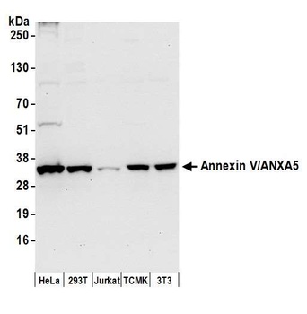 Rabbit anti-Annexin V/ANXA5 Antibody, Affinity Purified