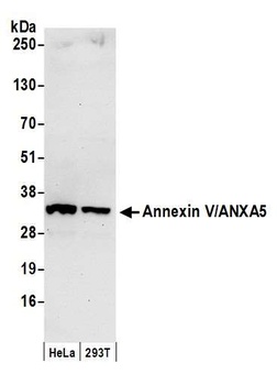 Rabbit anti-Annexin V/ANXA5 Antibody, Affinity Purified