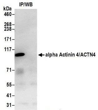 Rabbit anti-alpha Actinin 4/ACTN4 Antibody, Affinity Purified