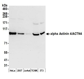Rabbit anti-alpha Actinin 4/ACTN4 Antibody, Affinity Purified
