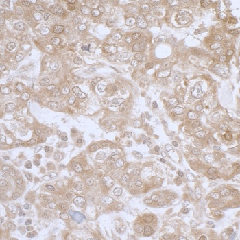 Rabbit anti-PHGDH Antibody, Affinity Purified