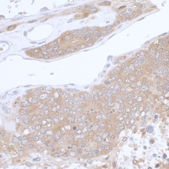Rabbit anti-PHGDH Antibody, Affinity Purified