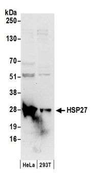 Rabbit anti-HSP27 Antibody, Affinity Purified