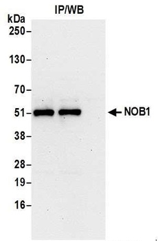 Rabbit anti-NOB1 Antibody, Affinity Purified