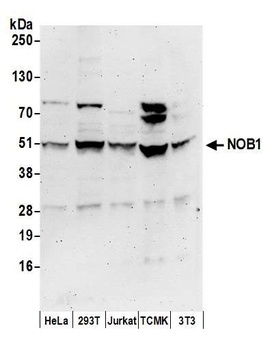 Rabbit anti-NOB1 Antibody, Affinity Purified