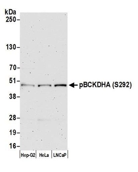 Rabbit anti-BCKDHA, Phospho (S292) Antibody, Affinity Purified