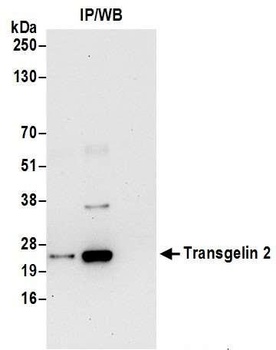 Rabbit anti-Transgelin 2 Antibody, Affinity Purified