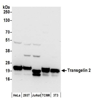 Rabbit anti-Transgelin 2 Antibody, Affinity Purified