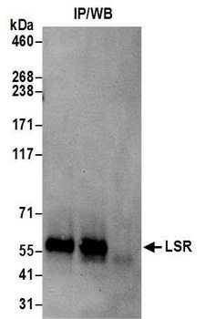 Rabbit anti-LSR Antibody, Affinity Purified
