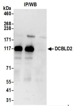 Rabbit anti-DCBLD2 Antibody, Affinity Purified