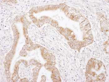 Rabbit anti-Rictor Antibody, Affinity Purified