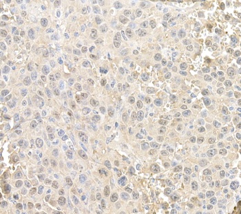 Rabbit anti-RAN Antibody, Affinity Purified