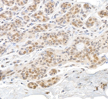 Rabbit anti-RAN Antibody, Affinity Purified