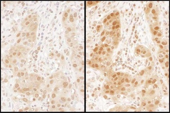 Rabbit anti-RAN Antibody, Affinity Purified