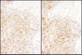 Rabbit anti-RAN Antibody, Affinity Purified