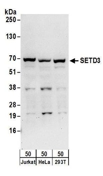 Rabbit anti-SETD3 Antibody, Affinity Purified