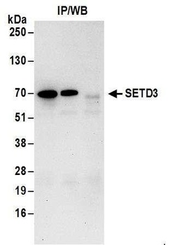 Rabbit anti-SETD3 Antibody, Affinity Purified