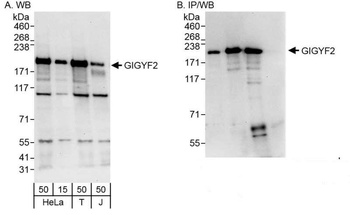 Rabbit anti-GIGYF2 Antibody, Affinity Purified