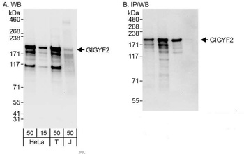 Rabbit anti-GIGYF2 Antibody, Affinity Purified