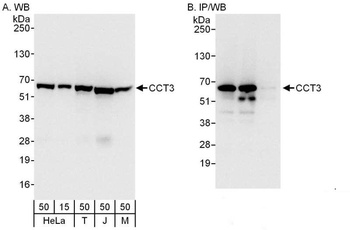 Rabbit anti-CCT3 Antibody, Affinity Purified