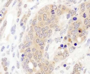 Rabbit anti-CCT3 Antibody, Affinity Purified