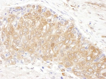 Rabbit anti-CCT3 Antibody, Affinity Purified