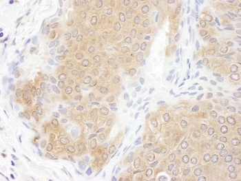 Rabbit anti-CCT3 Antibody, Affinity Purified