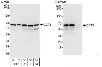 Rabbit anti-CCT3 Antibody, Affinity Purified