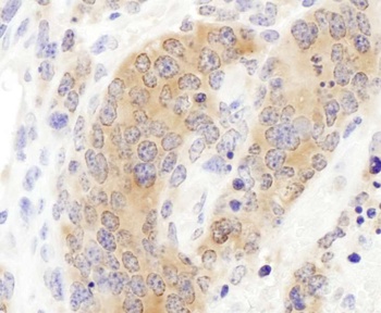 Rabbit anti-CCT3 Antibody, Affinity Purified