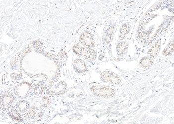 Rabbit anti-SNRNP200 Antibody, Affinity Purified