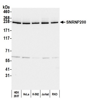 Rabbit anti-SNRNP200 Antibody, Affinity Purified