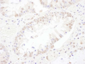 Rabbit anti-SNRNP200 Antibody, Affinity Purified