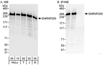 Rabbit anti-SNRNP200 Antibody, Affinity Purified