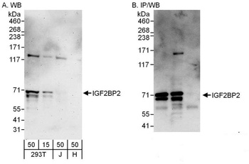 Rabbit anti-IGF2BP2 Antibody, Affinity Purified