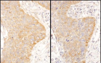 Rabbit anti-IGF2BP2 Antibody, Affinity Purified