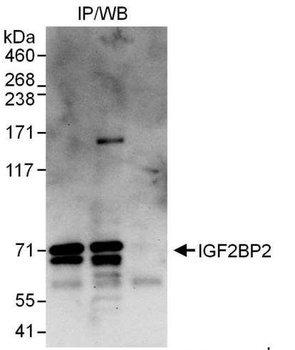 Rabbit anti-IGF2BP2 Antibody, Affinity Purified