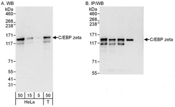 Rabbit anti-C/EBP zeta Antibody, Affinity Purified