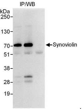 Rabbit anti-Synoviolin Antibody, Affinity Purified